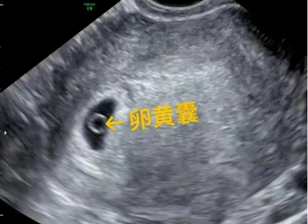 图片 1.png