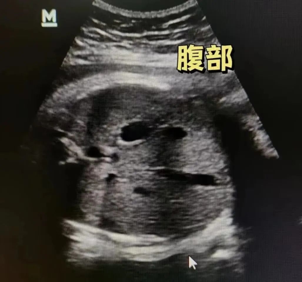 图片 1.png